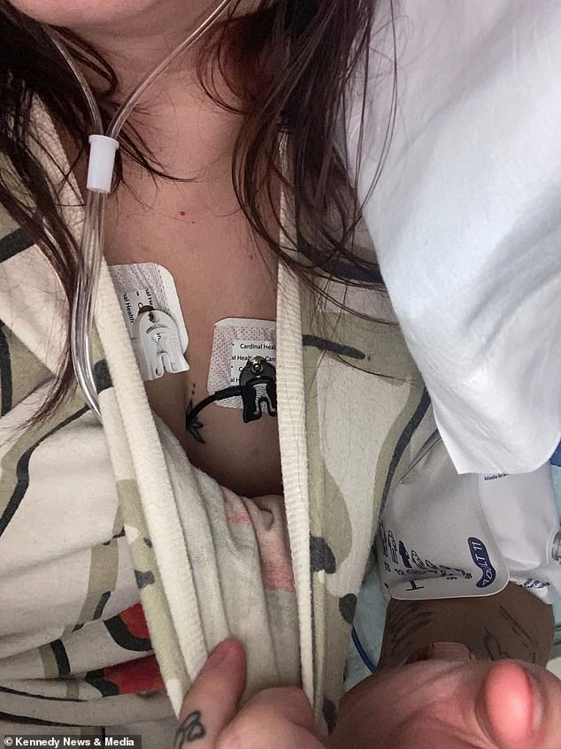 Eyes is pictured above in the hospital while she received treatment for popcorn lung and fluid build up in the organs