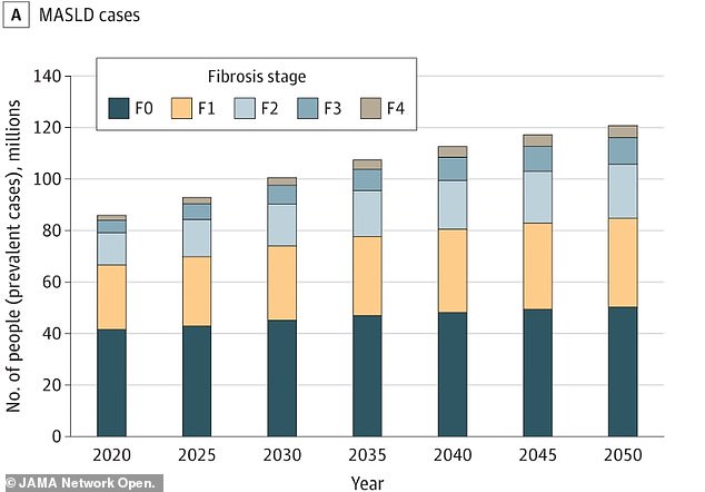 The graph comes from an unrelated study that projected the number of US adults with MASLD will rise from 86 million (33.7 percent) in 2020 to 122 million (41.4 percent) by 2050