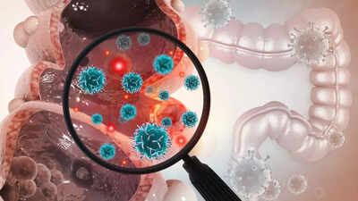 5 warning signs of bowel cancer and how to reduce the risk, according to a gut expert