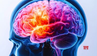 UK study identifies 8 new schizophrenia genes