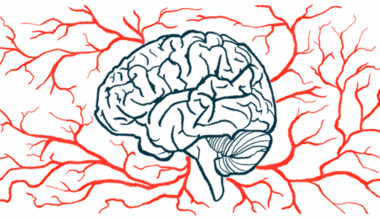 Blood vessels surround a brain.