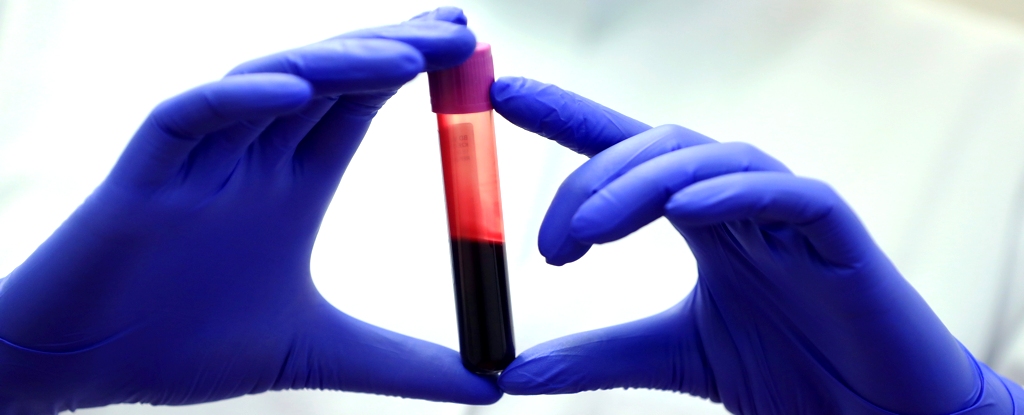 The Blood of Exceptionally Long-Lived People Suggests Key Differences : ScienceAlert