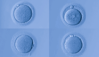 A collage of human egg cells.
