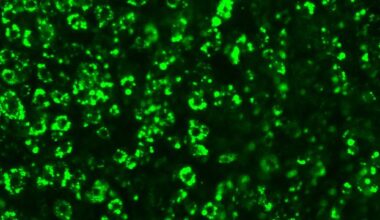 CRISPR Finds New Drug Targets for Obesity
