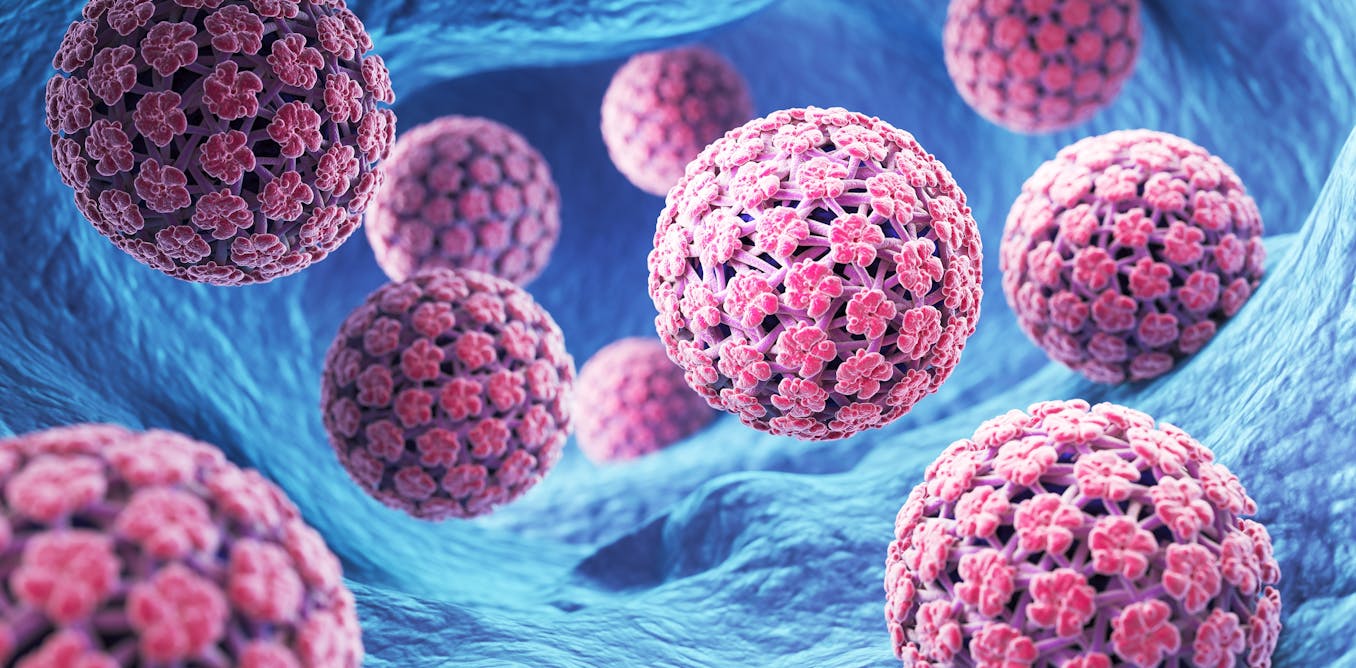 is HPV also a potential cause?