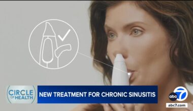 XHANCE: New FDA-approved nasal device offers relief for chronic sinusitis