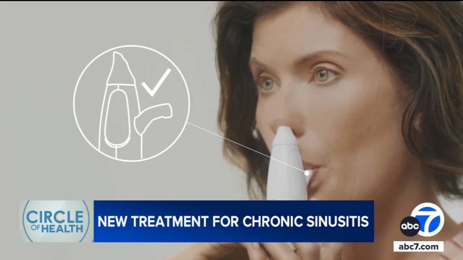 XHANCE: New FDA-approved nasal device offers relief for chronic sinusitis