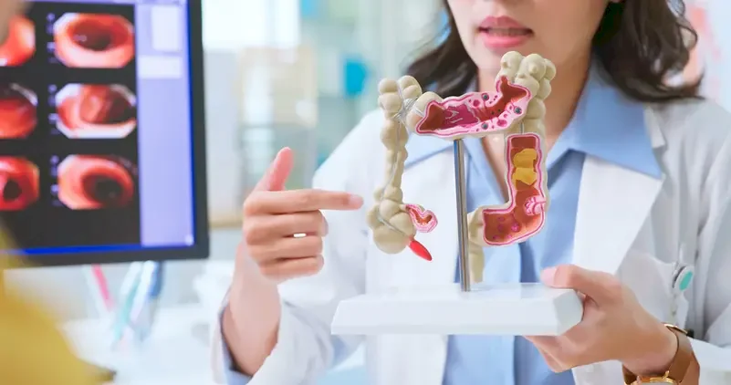 The Benefits of Exercise for Gut Health