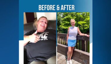 Are weight loss drugs safe? Florida expert weighs in on semaglutide and tirzepatide