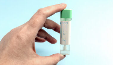 GPs ‘central’ to DNA screening uptake