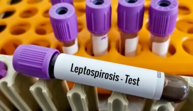 Leptospirosis death reported as Chicago issues health alert – NBC Chicago
