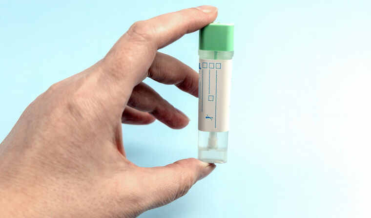  A hand holds a saliva specimen tube.