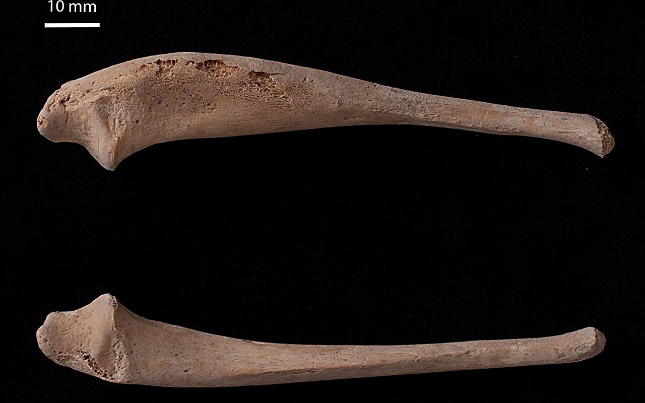 Rare disease possibly identified in 12th century child's skeletal remains