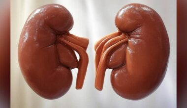 Kidney disease mystery in Telangana: Unprescribed alternative herbal medicines among culprits - The South First