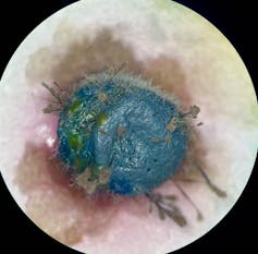 black plastic bead with microbes growing on surface