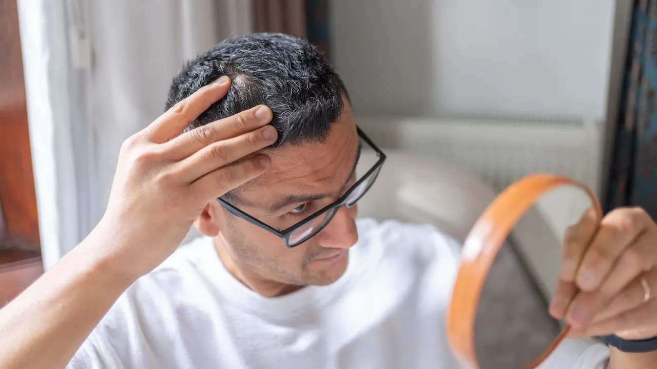 New hair loss treatment shows significant improvement over placebo