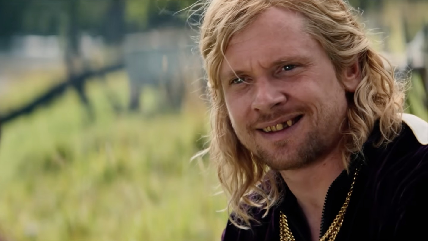 The Bone Temple Trailer Teases Major Clash