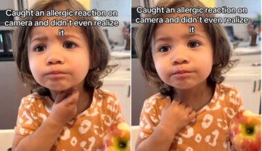 Mom Took a Video of Her Daughter Eating an Apple. She Didn't Realize She Was Capturing an Allergic Reaction (Exclusive)