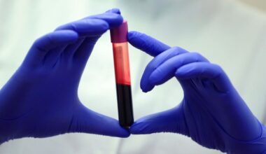 Blood of Exceptionally Long-Lived People Reveals Crucial Differences : ScienceAlert