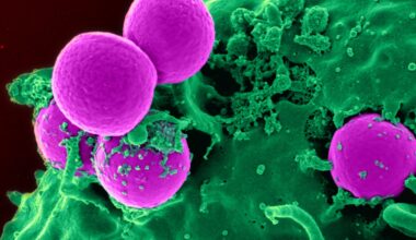 Grim Signals of Future Antimicrobial Resistance Found Lurking in Sewage : ScienceAlert