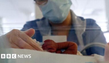 Epidural kit shortage could last until March, regulator says