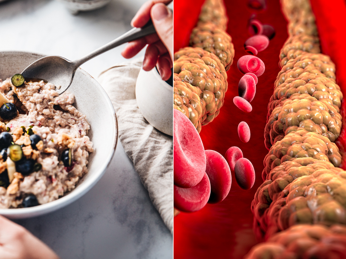 From Oats to Olive Oil: The Everyday Habits That Slash “Bad” Cholesterol