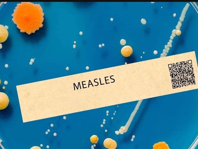 Possible Measles Exposure At Newark Airport Amid Holiday Travel: Health Officials