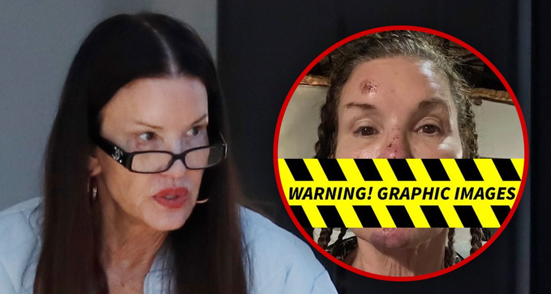 Janice Dickinson Spotted After Sharing Alleged Injuries From Reality Show Fall