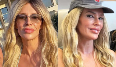 Brandi Glanville Debuts New Look Ahead of Sundance Film Festival, Thanks Her Plastic Surgeon