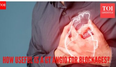 Do you really need a CT Angiography to detect heart blockages? Leading doctor busts some myths