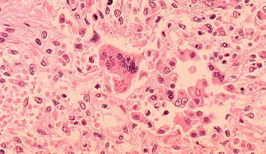 NJ health officials warn of possible measles exposure at Newark airport