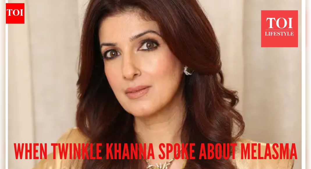 When Twinkle Khanna opened up on melasma, calling it a 'bin bulaya mehman': here's what we know on the condition