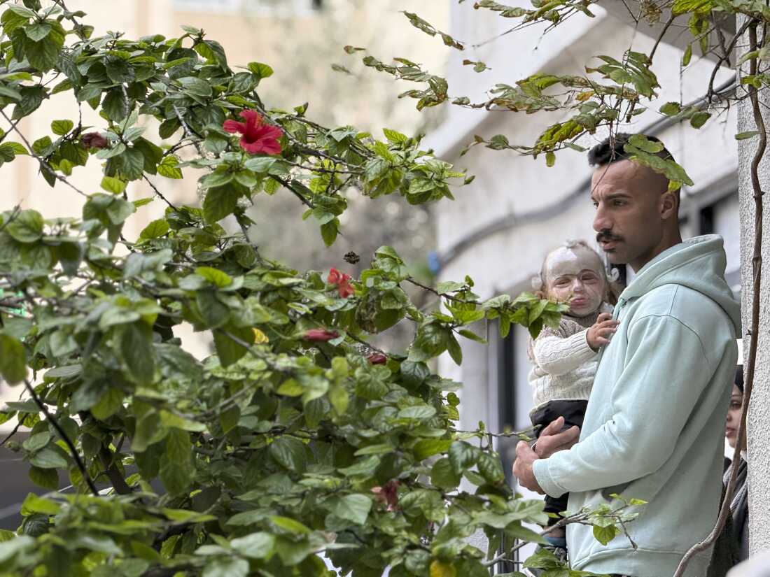 A young Palestinian boy wounded in the war by an Israeli airstrike is held by his father at MSF’s clinic in Gaza City on Dec. 31, 2025.