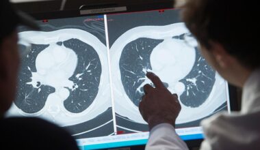 Better outcomes for cancer diagnoses: 7 in 10 survive 5 years or more