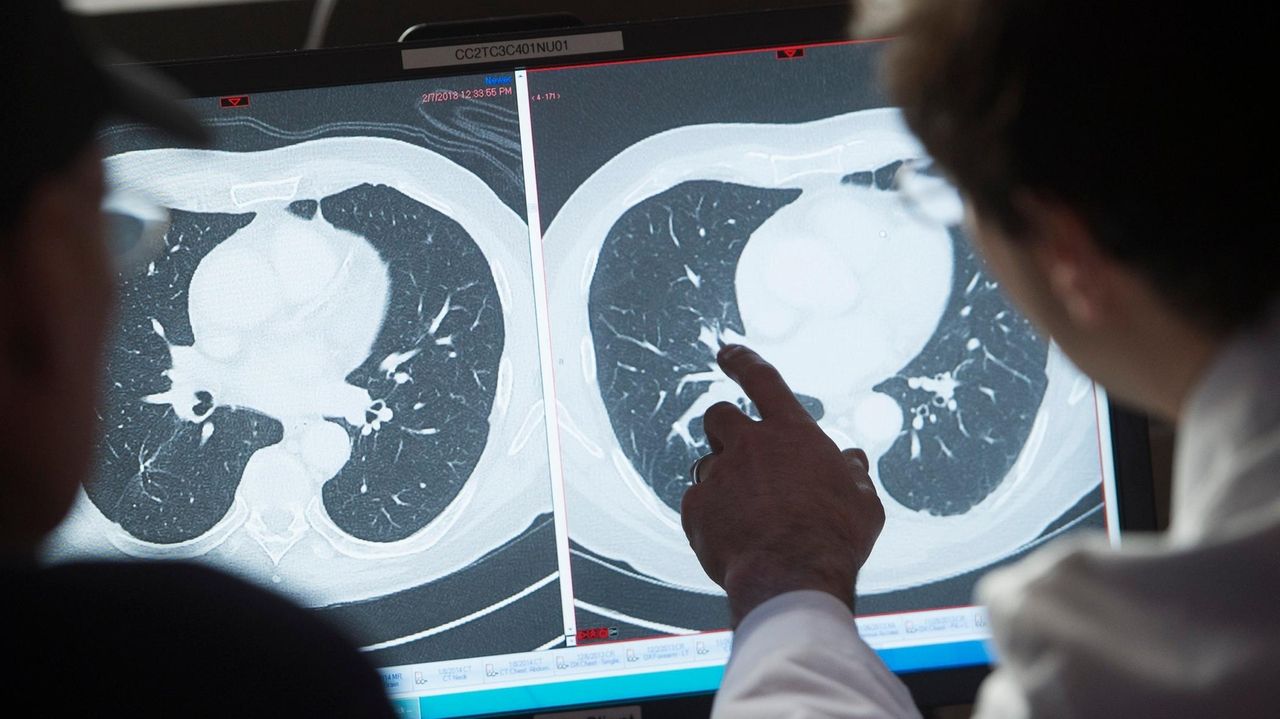 Better outcomes for cancer diagnoses: 7 in 10 survive 5 years or more