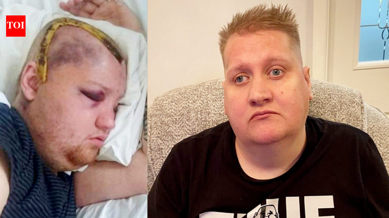 ‘It’s a nightmare’: UK man sues NHS after receiving eight years of chemotherapy instead of six months |