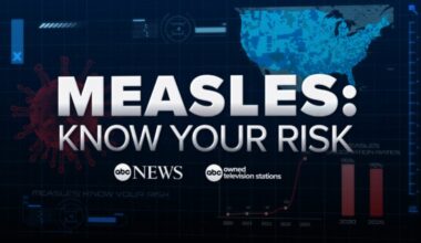 Measles outbreak map: How to spot the disease risk level in your ZIP code