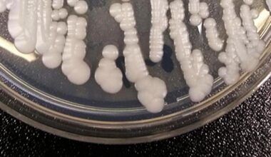 CT experts warn of new ‘superbug’ fungus resistant to treatment