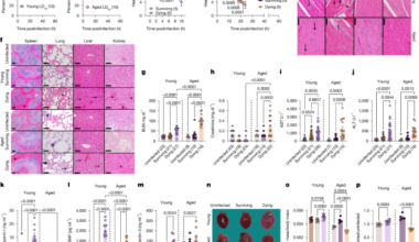 Disease tolerance and infection pathogenesis age-related tradeoffs in mice
