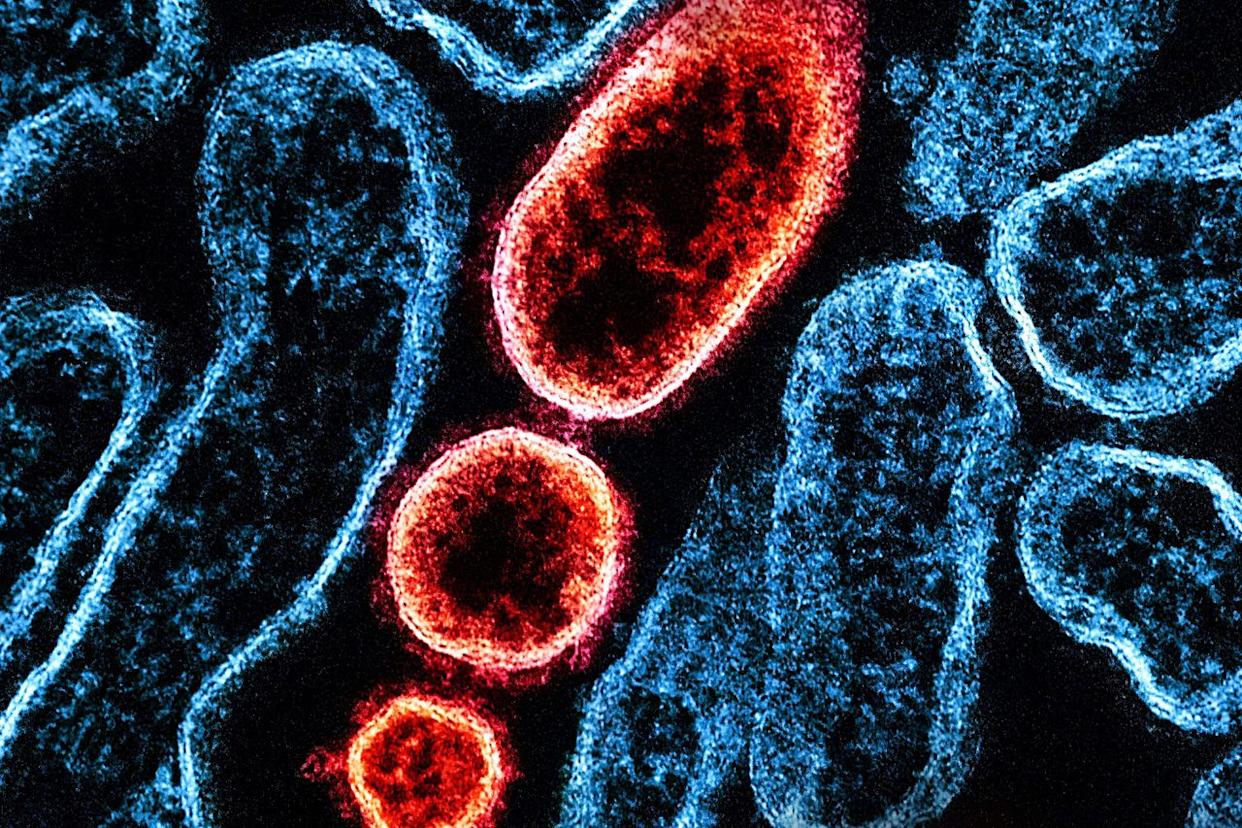 NIH-NIAID/Image Point FR/BSIP/Universal Images Group via Getty  Nipah virus particles