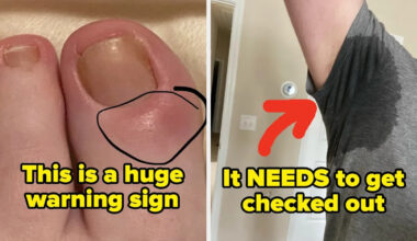 Medical Professionals Are Revealing The "Small" Health Signs You Should Never, Ever Ignore