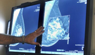 Medicaid changes may increase Louisiana cancer mortality | Health care/Hospitals