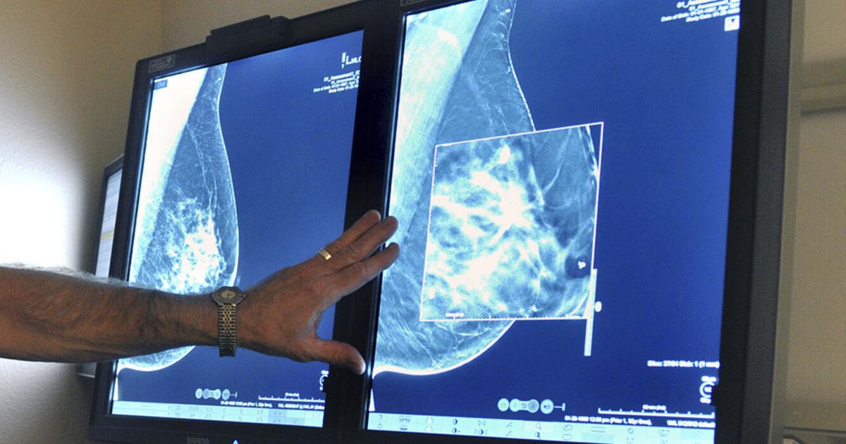 Medicaid changes may increase Louisiana cancer mortality | Health care/Hospitals