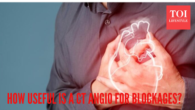 Do you really need a CT Angiography to detect heart blockages? Leading doctor busts some myths
