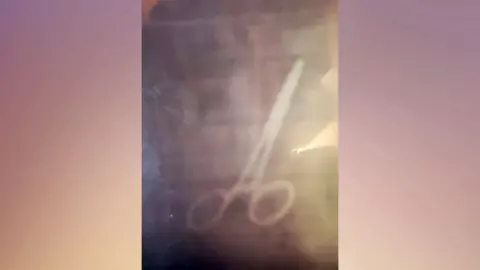 Abubakar Mohammed Scan result showing a pair of scissors inside a body