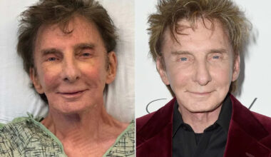 Barry Manilow, 82, Posts a Selfie from His Hospital Bed and Shares Health Update After Lung Cancer Diagnosis
