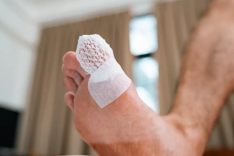 Close-up of a foot with a bandaged big toe, suggesting a recent injury or medical treatment