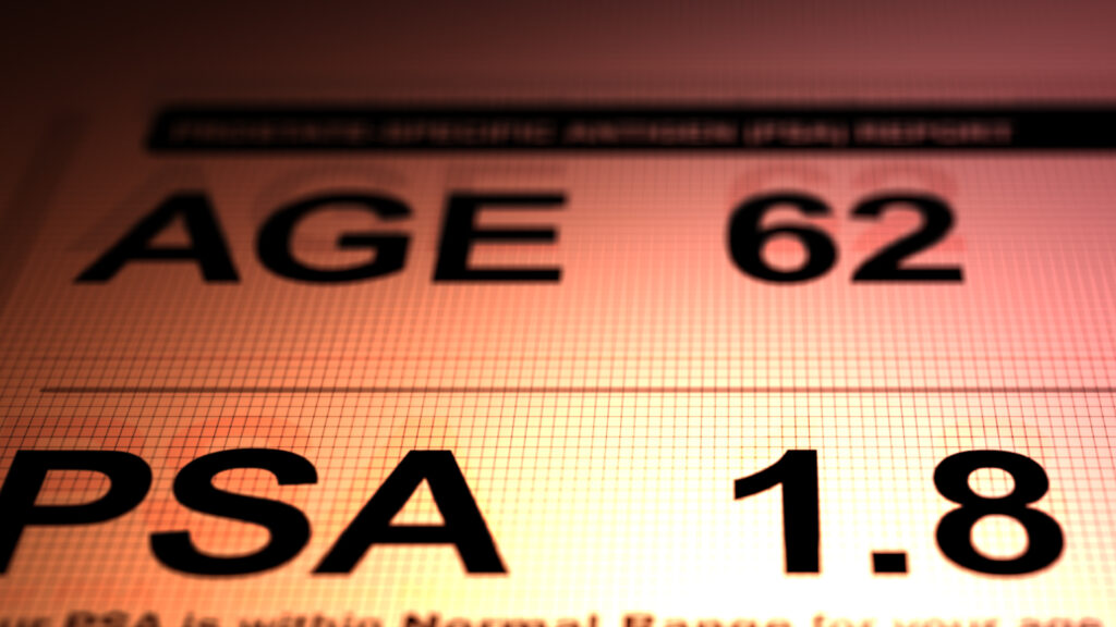 What PSA test reliance gets wrong about prostate cancer treatment