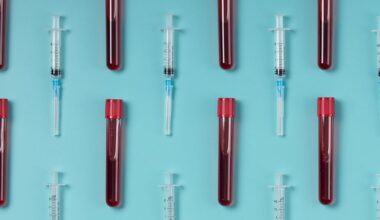 Blood Feud: Oura’s Health Panels Versus Whoop’s Advanced Labs