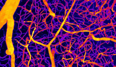 A Single Molecule May Explain How Blood Flow in The Brain Triggers Dementia : ScienceAlert